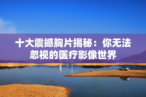十大震撼胸片揭秘：你无法忽视的医疗影像世界